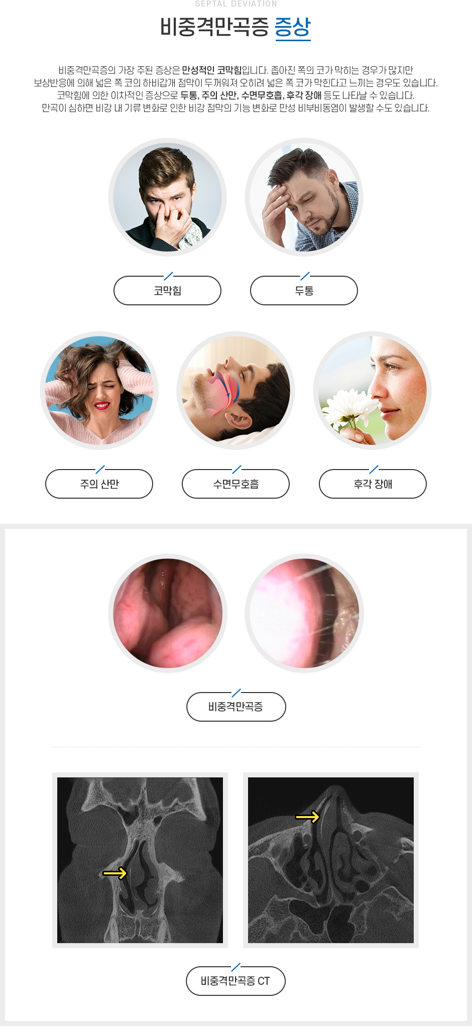 비중격만곡증 증상