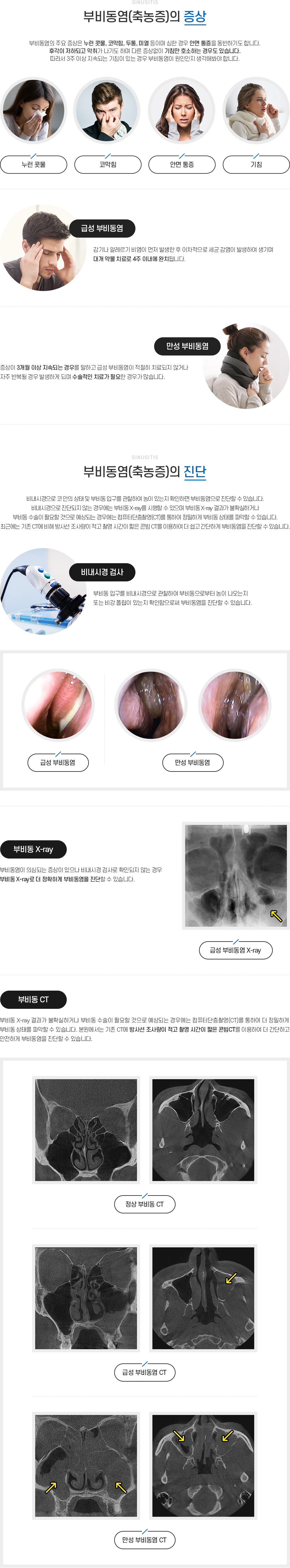 부비동염(축농증) 증상